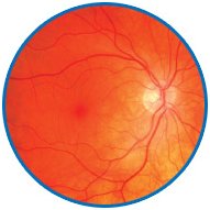 Retinal Scan Image 